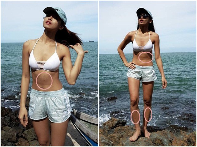 Khoe hình bikini, ứng viên Hoa hậu Hoàn vũ lộ miếng dán ngực kém duyên