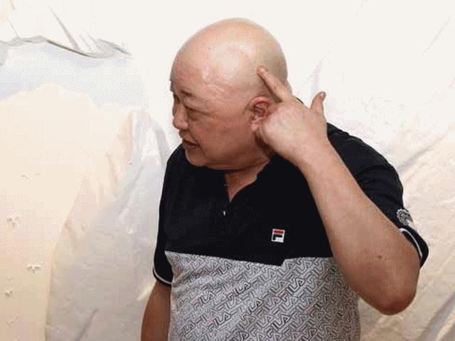 ”Bao Công” Kim Siêu Quần lần đầu xuất hiện sau đại phẫu u não
