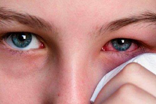 Mùa World Cup: Cẩn trọng với vết máu đỏ trong mắt khi xem bóng liên tục - 1