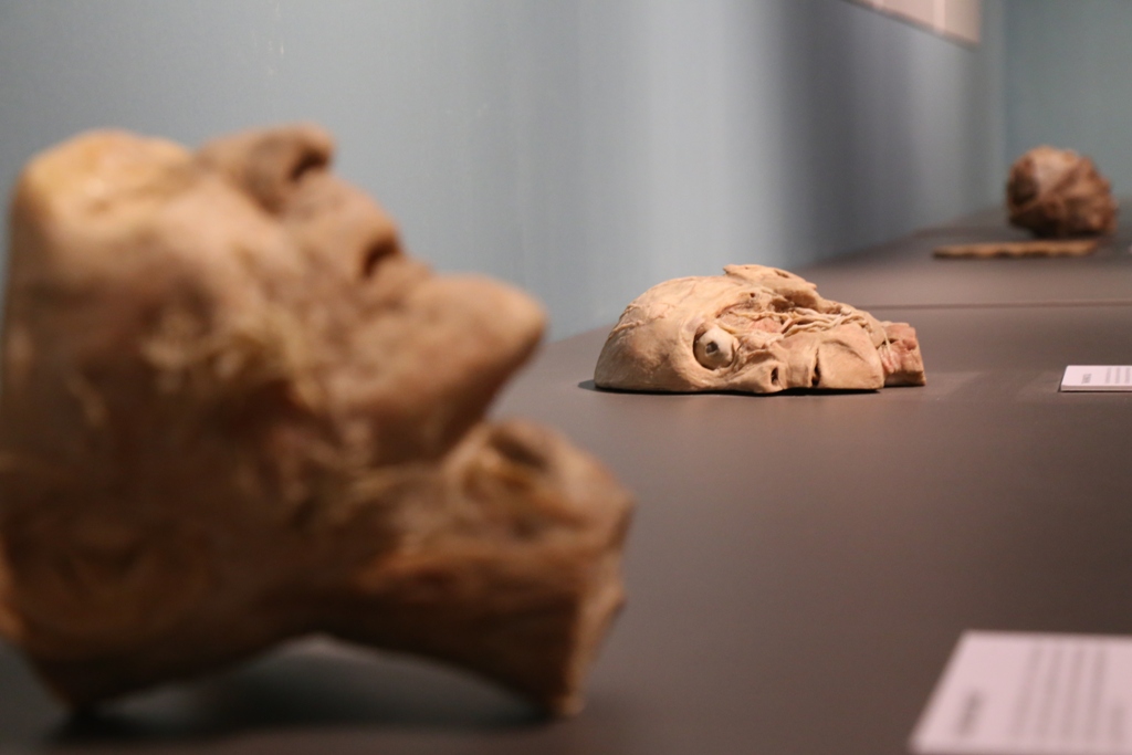 Bên trong triển lãm trưng bày xác người ở TP.HCM - 2