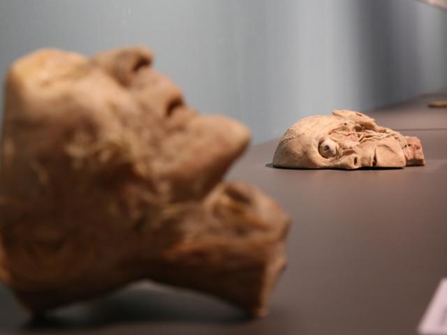 Tin tức trong ngày - Bên trong triển lãm trưng bày xác người ở TP.HCM