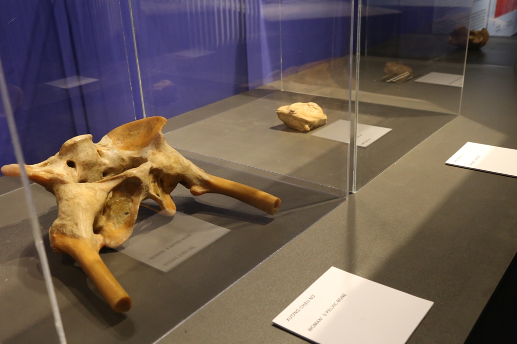 Bên trong triển lãm trưng bày xác người ở TP.HCM - 5