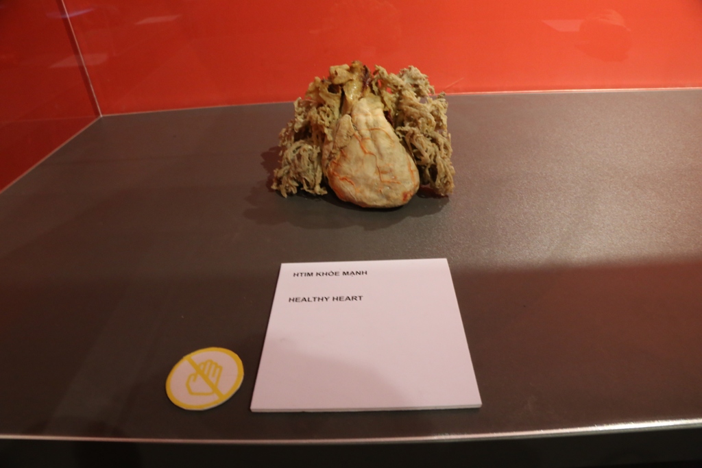 Bên trong triển lãm trưng bày xác người ở TP.HCM - 8