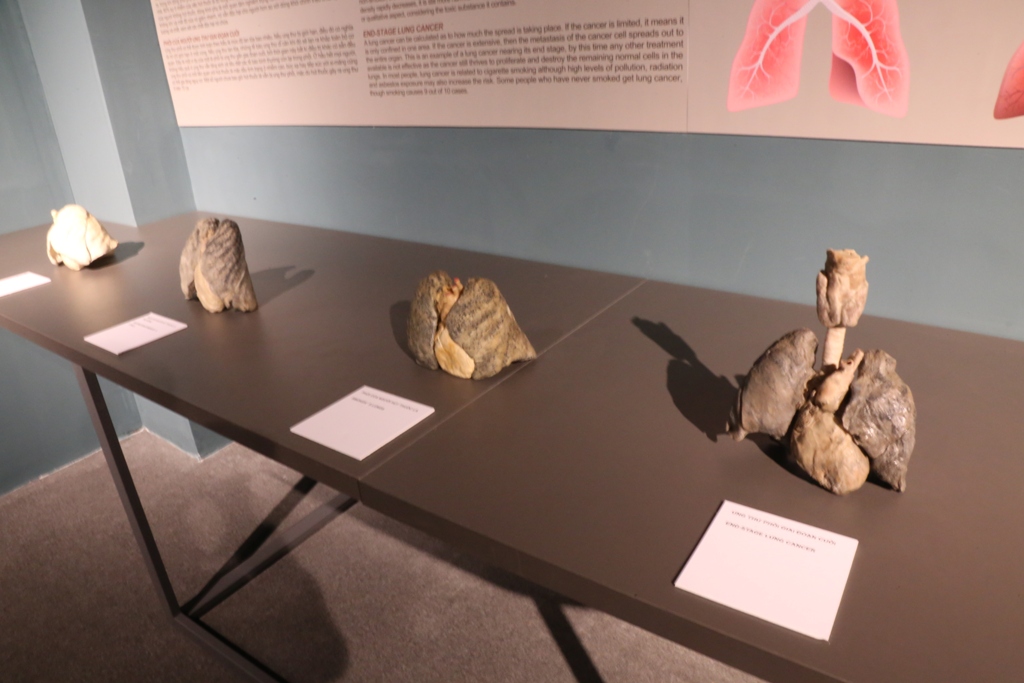 Bên trong triển lãm trưng bày xác người ở TP.HCM - 10