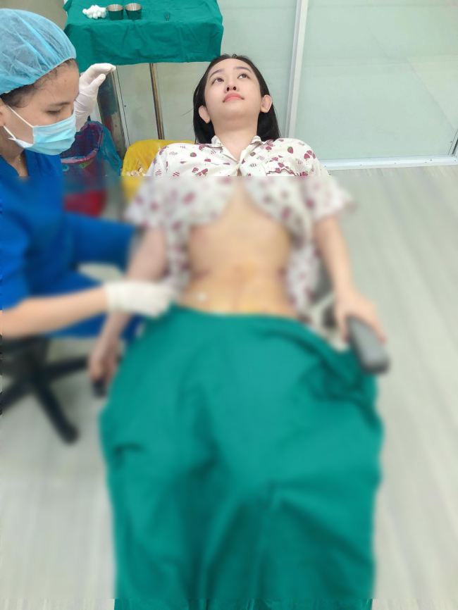 Hotgirl Thuý Vi tốn 170 triệu nhập viện hút 2kg mỡ bụng - 1