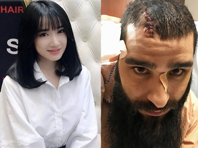 Giải trí - 24H HOT: Khui hồ sơ hành hung đạo diễn "Kong", nghi án Trường Giang ép Nhã Phương