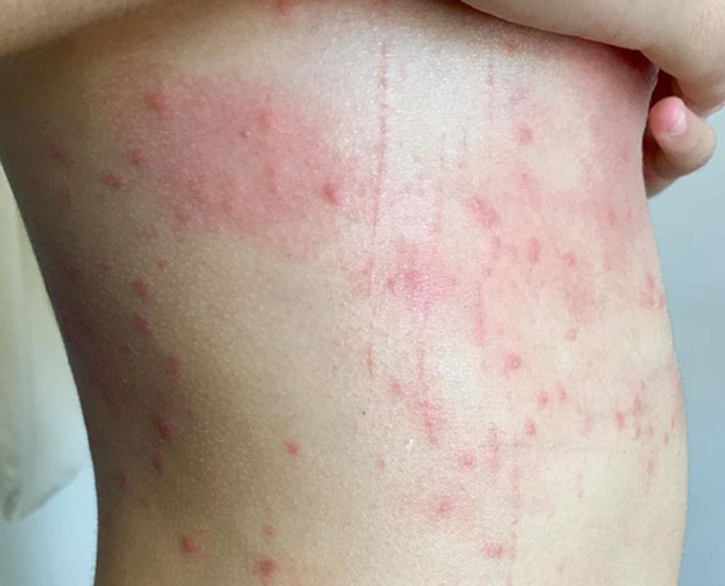 Vụ tắm biển Đà Nẵng bị mẩn ngứa: Kết quả phân tích mẫu nước có gì? - 1