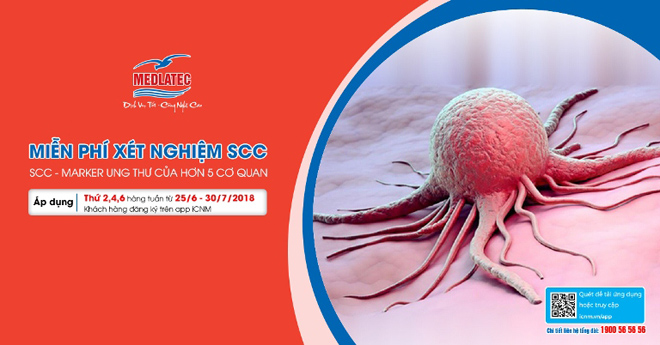 Top 5 nguyên nhân hàng đầu dẫn đến ung thư bạn nên tránh xa - 4