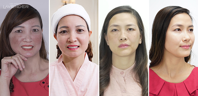 Vợ kém chồng chục tuổi vẫn bị chê già vì nỗi ám ảnh này - 5