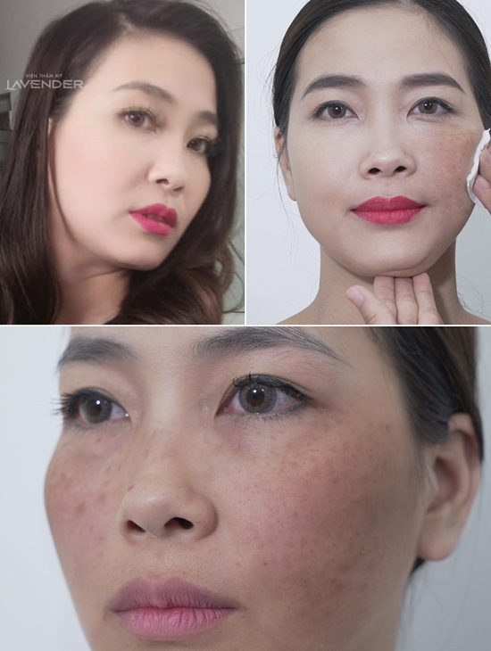 Vợ kém chồng chục tuổi vẫn bị chê già vì nỗi ám ảnh này - 2