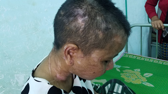 Gia Lai hỏa tốc yêu cầu xử lý vụ cô gái bị tra tấn dã man như thời Trung Cổ - 1