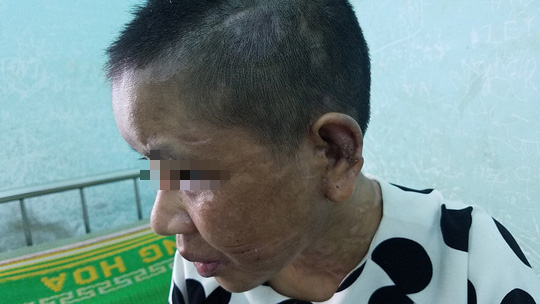 Lời kể rùng rợn của cô gái nghi bị chủ tra tấn dã man - 2