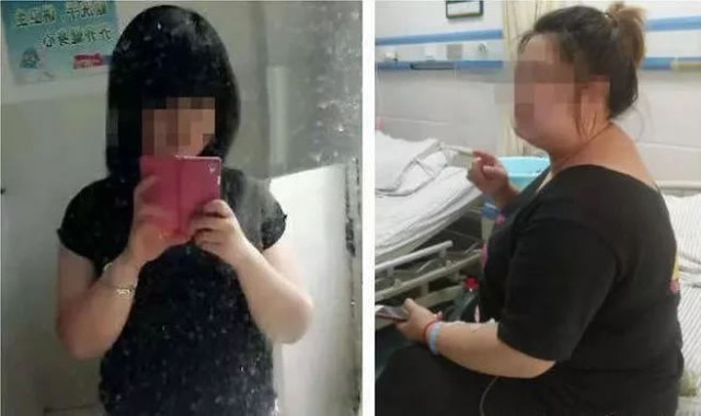 Cô gái phải nhập viện để hút mỡ bụng vì uống thuốc giảm cân quá lâu - 1