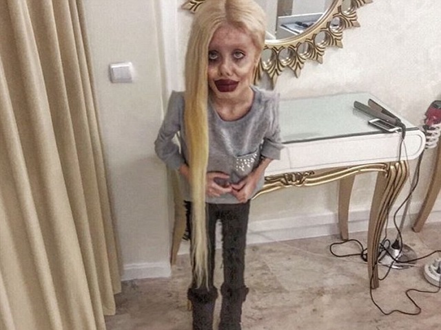 Tư vấn làm đẹp - "Angelina Jolie lỗi" từng gây chấn động vì quá kỳ dị vừa lộ mặt thật