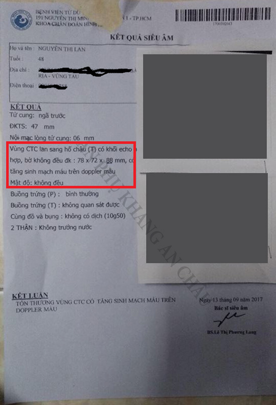 Dùng tam thất “không đúng” - u xơ tử cung càng ngày càng to - 2