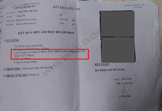 Dùng tam thất “không đúng” - u xơ tử cung càng ngày càng to - 3