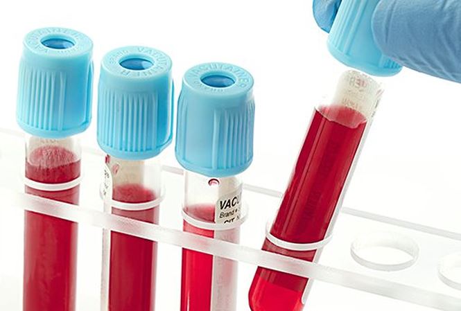 Sốc với kết quả xét nghiệm hoá chất độc hại trong máu của người Hà Nội - 1