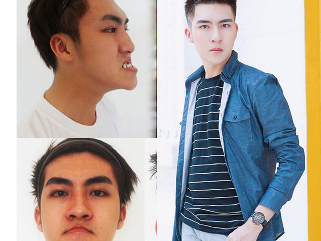 Bí quyết làm đẹp - Những cô gái, chàng trai Việt "lột xác" nhờ thẩm mỹ có sợ sinh con như bản gốc?