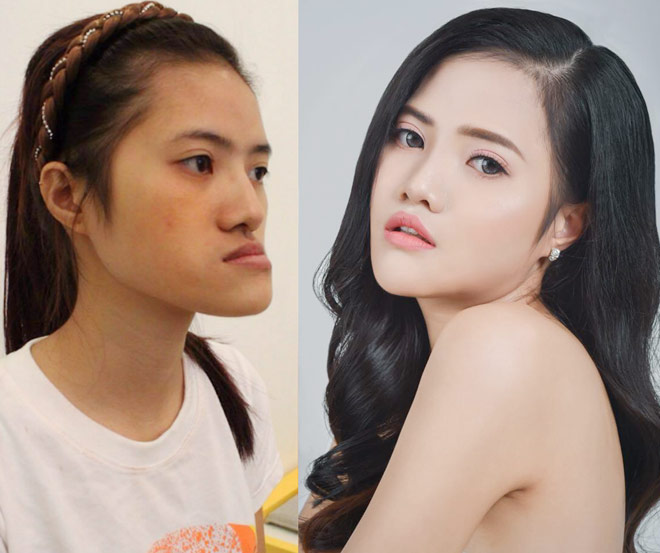 Những cô gái, chàng trai Việt "lột xác" nhờ thẩm mỹ có sợ sinh con như bản gốc? - 4