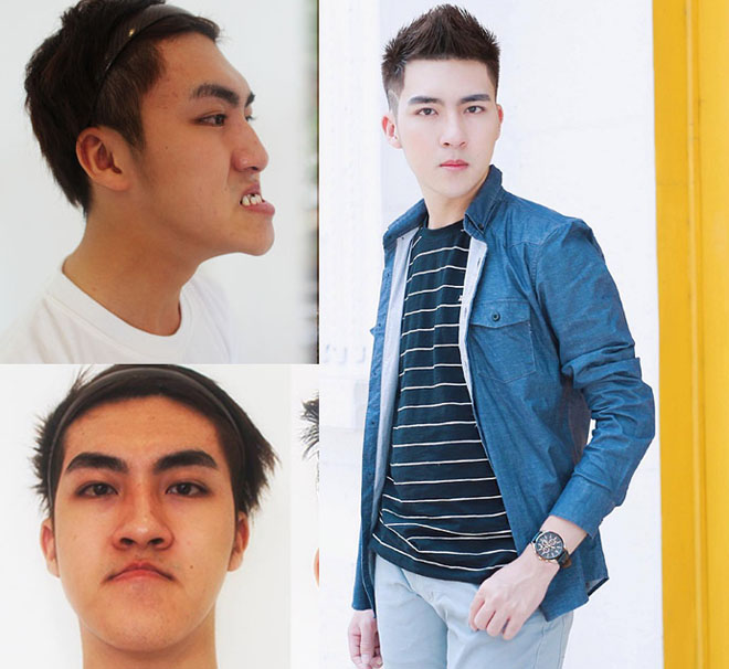 Những cô gái, chàng trai Việt "lột xác" nhờ thẩm mỹ có sợ sinh con như bản gốc? - 2