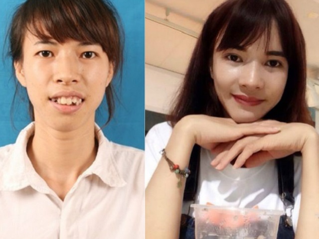 Những cô gái, chàng trai Việt "lột xác" nhờ thẩm mỹ có sợ sinh con như bản gốc? - 5