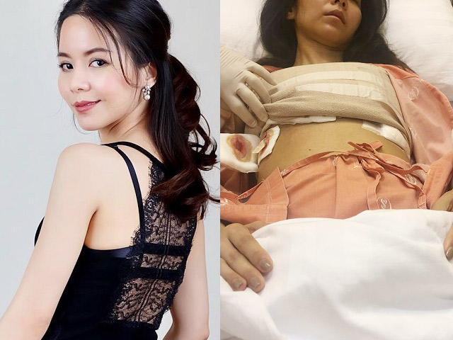 Danh ca Thái Lan thập tử nhất sinh vì nâng ngực, đòi bồi thường 14 tỷ - 3