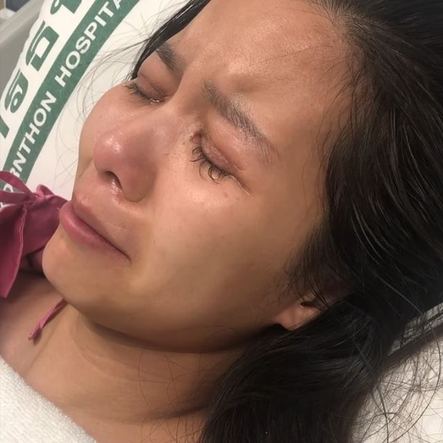 Danh ca Thái Lan thập tử nhất sinh vì nâng ngực, đòi bồi thường 14 tỷ - 5