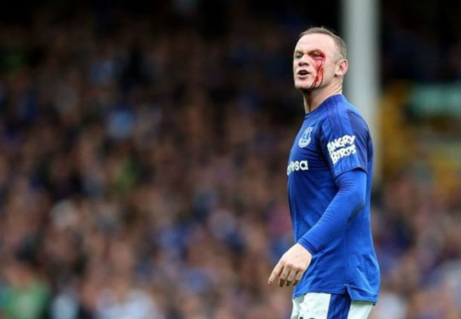 Rooney đổ máu khâu 5 mũi: Rực lửa nhuộm đỏ MLS, có phải giải nghệ sớm? - 7