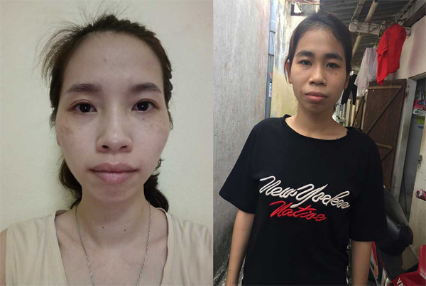 Thí sinh Hành trình lột xác 2018 được áp dụng những công nghệ làm đẹp hàng đầu hiện nay - 4