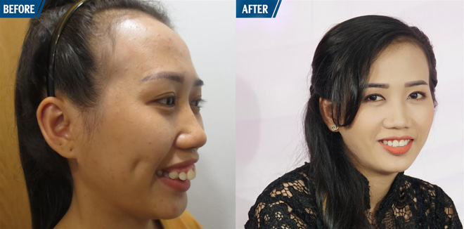 Ca sĩ Khánh Ngọc bất ngờ xuất hiện trong chương trình “Nhan sắc mới - Khởi đầu mới” - 4