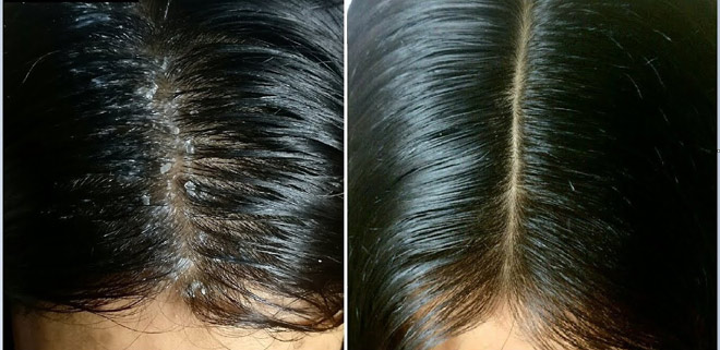 Giải mã 4 công dụng độc đáo ít ai biết của bồ kết với mái tóc bạn - 2