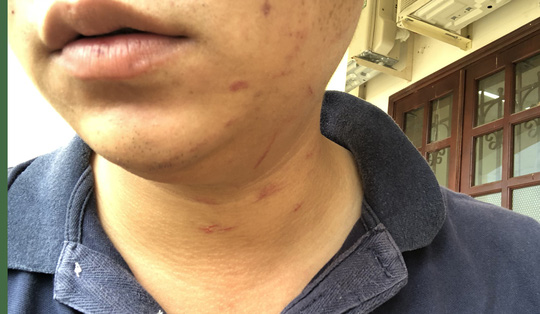 Khởi tố người đánh kiểm sát viên ở TAND huyện Bình Chánh - 2