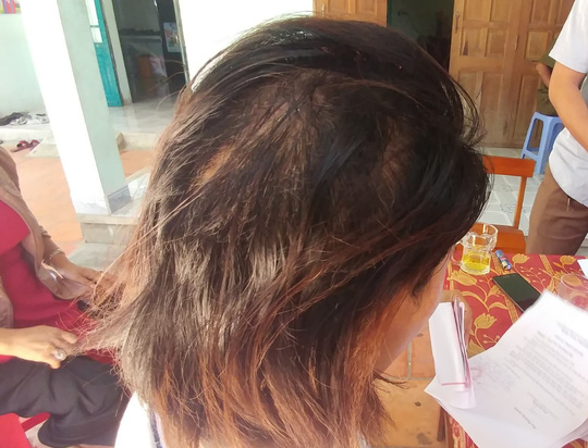 Sắp ly hôn, chồng dùng cuốc cuốc thẳng vào đầu vợ - 1