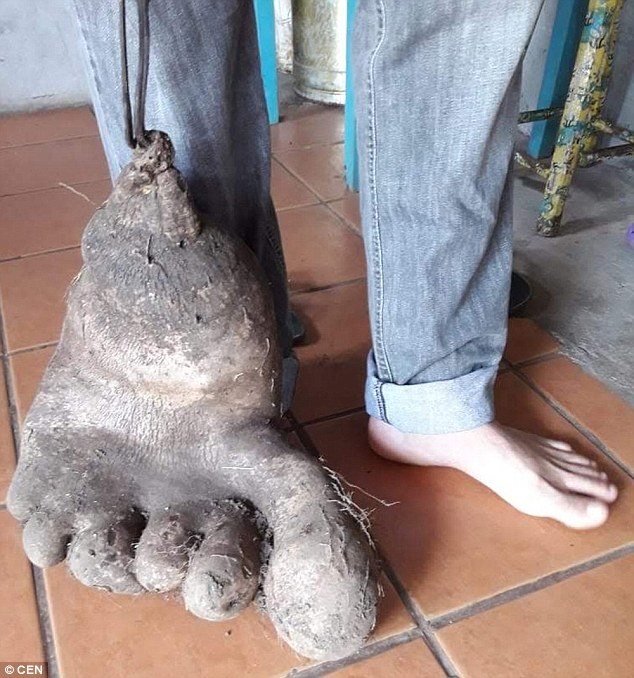 Củ khoai tây khổng lồ giống hệt bàn chân người - 2