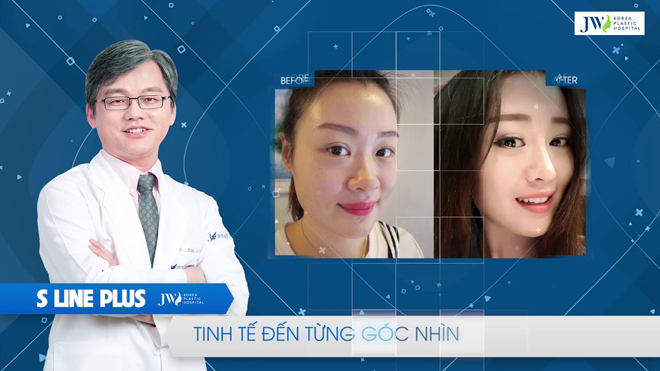 Bác sĩ Hàn Quốc hỗ trợ 100% chi phí PTTM ca mũi khó - 1