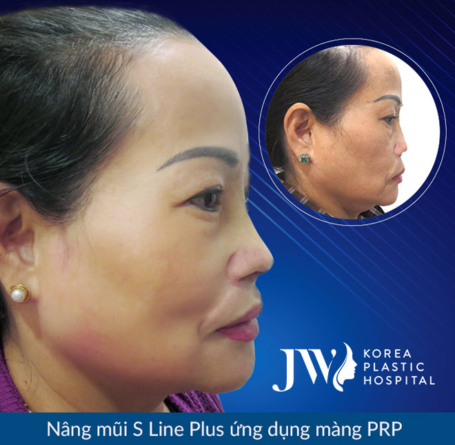 Nổi bật những ca mũi khó được giải cứu 2018 - 3