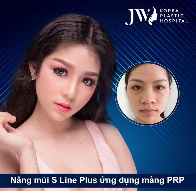 Nổi bật những ca mũi khó được giải cứu 2018 - 6