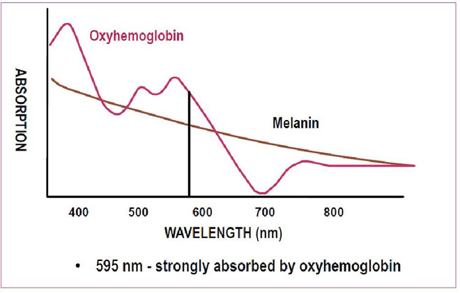 Synchro VasQ - Giải pháp hiệu quả nhất trong điều trị bệnh lý mạch máu - 2