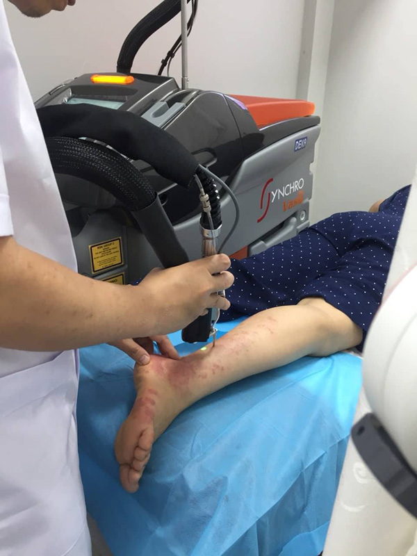 Synchro VasQ - Giải pháp hiệu quả nhất trong điều trị bệnh lý mạch máu - 5