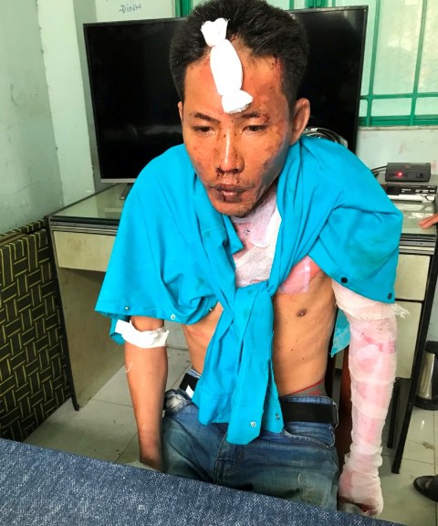 Vụ cha dượng đốt 3 người ở Đồng Nai: Hai cháu bé đã tử vong - 1