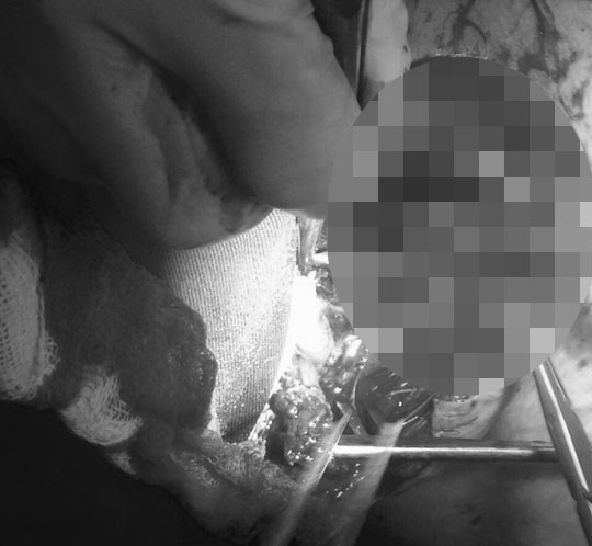 Can ngăn hai con chó béc giê cắn nhau, chủ nhà bị cắn đến chết - 1