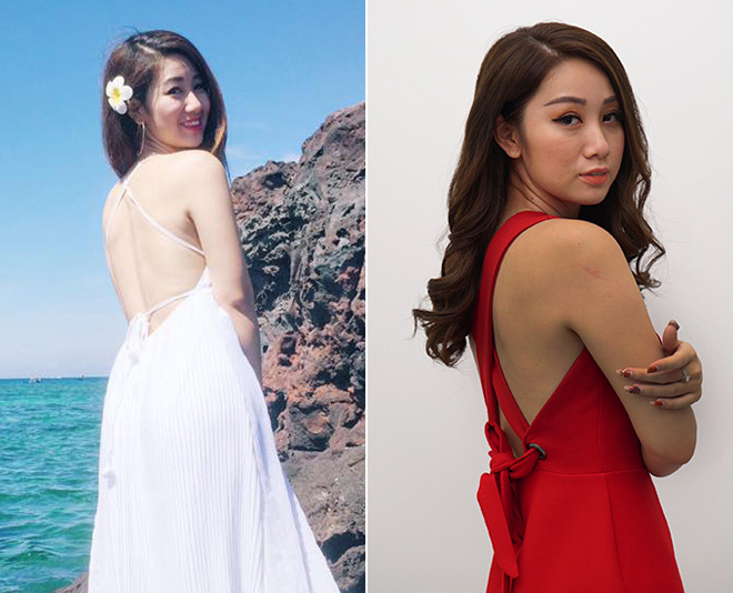 Hết mùa du lịch, chị em đua nhau tìm cách phục hồi da cháy nắng - 3