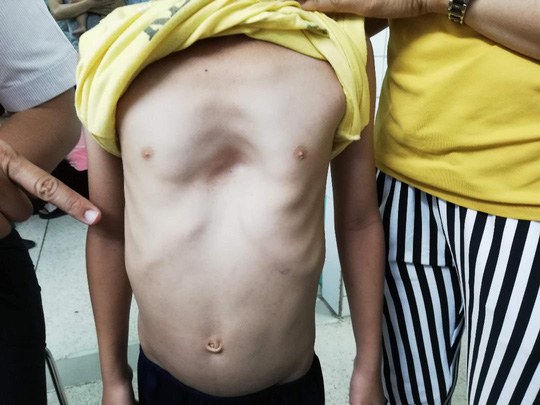 Bé trai bị 2 dị tật cực hiếm trên thế giới - 1