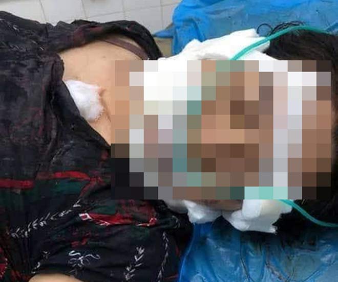 Cuộc đời đầy bi kịch của người đàn bà bị chồng rạch mặt dã man - 1