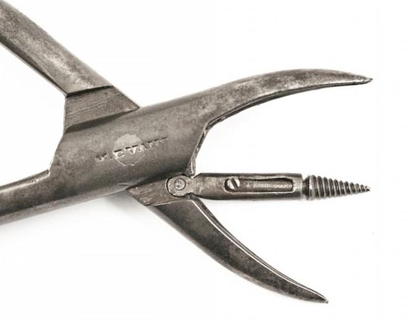 Không thể tin rằng 12 dụng cụ y tế đáng sợ này từng được sử dụng trên con người - 3