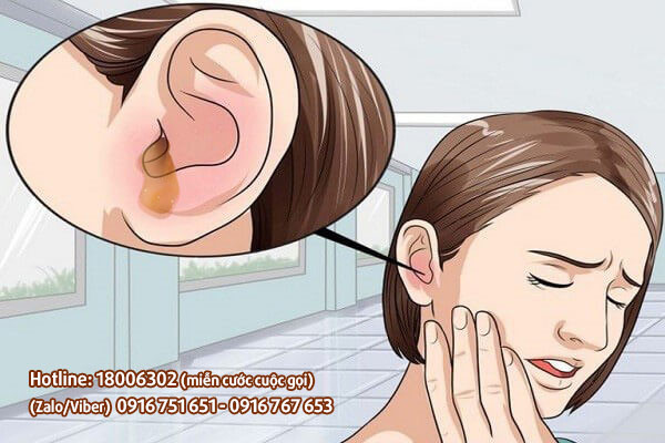 Nhiễm trùng tai – Nguyên nhân số 1 có thể gây điếc vĩnh viễn! - 1
