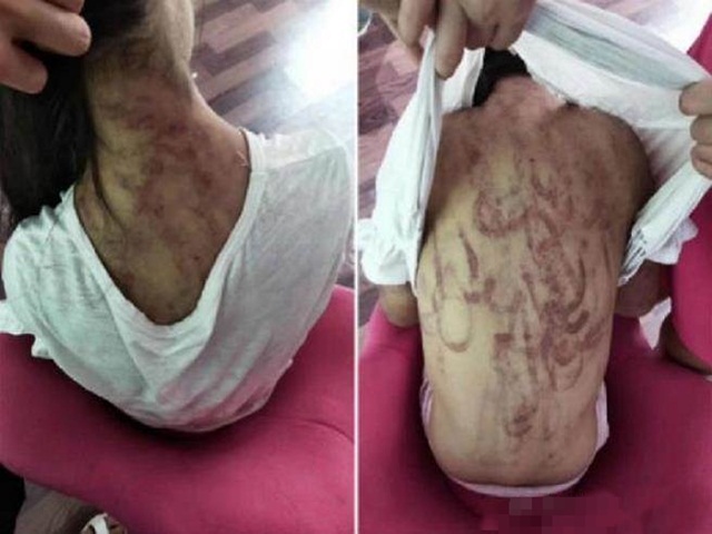 Bạn trẻ - Cuộc sống - Bé 12 tuổi trốn nhà bỏ đi và sự thật đáng sợ về người mẹ kế