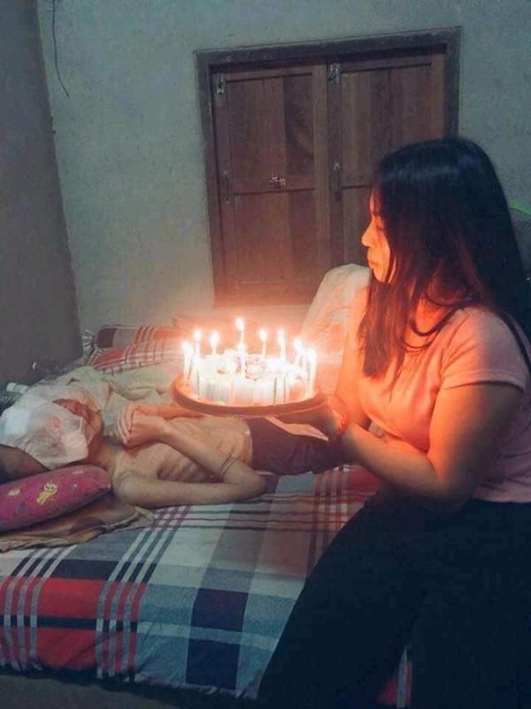 Chuyện tình cô gái và chàng trai bị biến dạng mặt vì ung thư mắt - 3