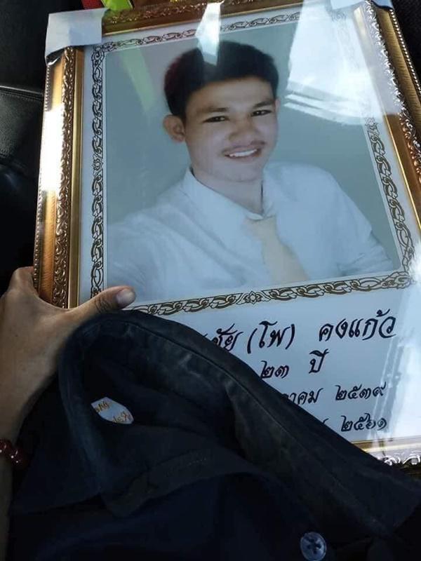 Chuyện tình cô gái và chàng trai bị biến dạng mặt vì ung thư mắt - 5