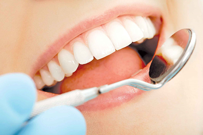 HOT: Bọc răng sứ không mài răng với giá chỉ 1.000đ! - 1